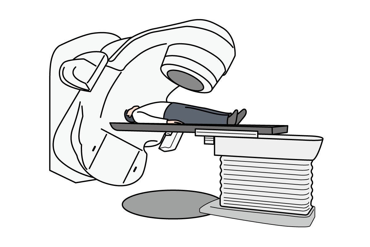 放射線治療の機器