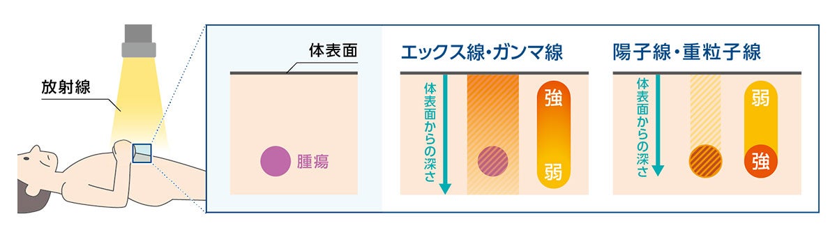 放射線の線量の大きさ・体表面からの深さ