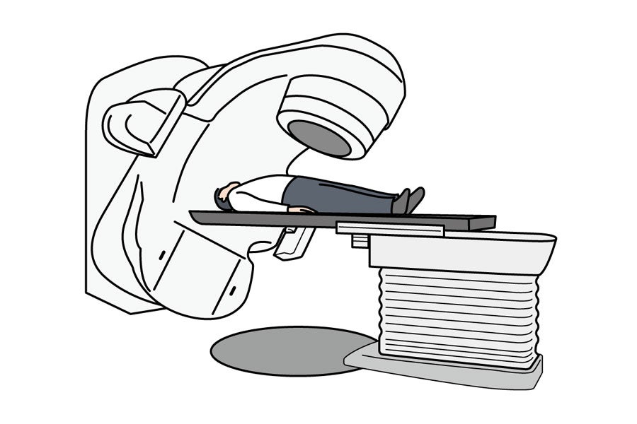 放射線治療の機器