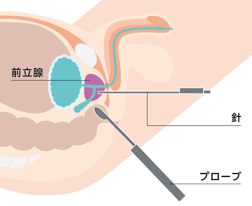 経会陰式の様子