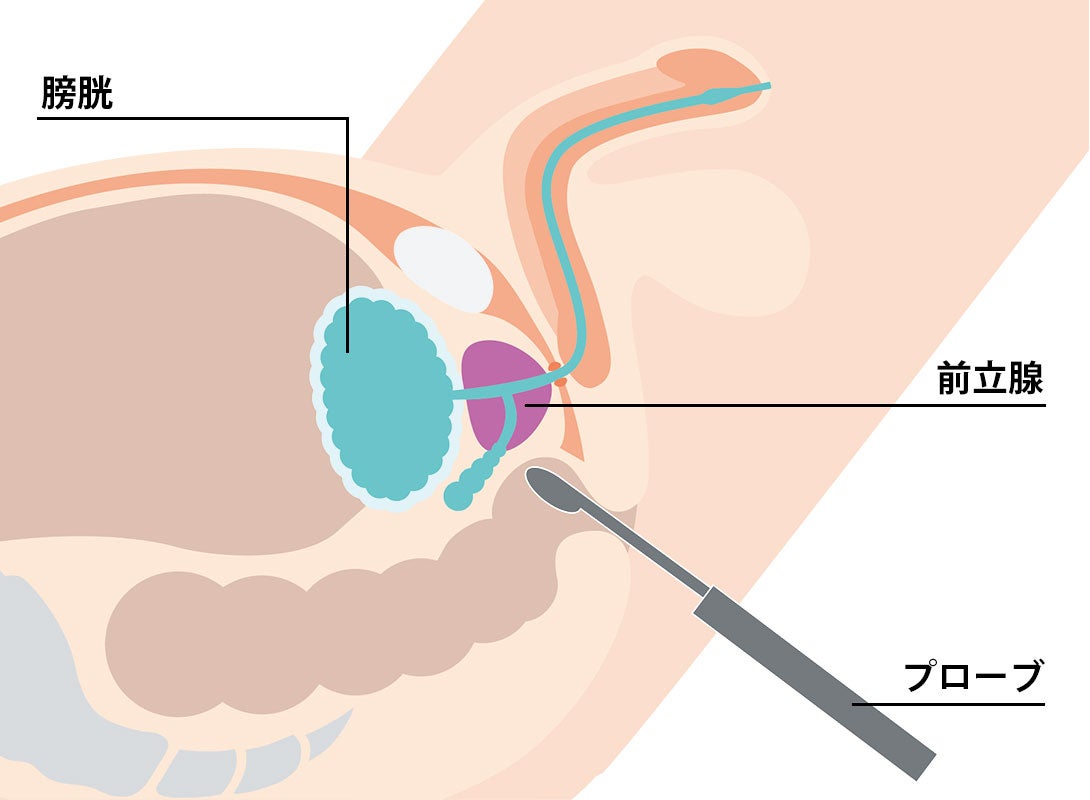 超音波検査の様子